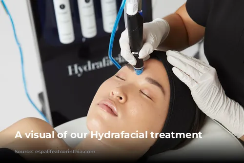 A visual of our Hydrafacial treatment